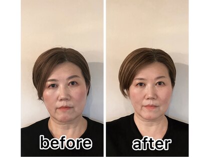 ドクターコガオ 福山店(Dr.小顔)の写真