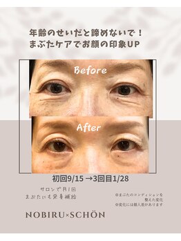 シェーン(schon)/ホームケアいらずの栄養補給