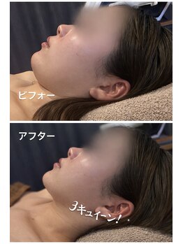 ルミナスの写真/骨格から整える感覚。小顔はもちろん、すっきりしたフェイスラインへ。むくみ/たるみ/ほうれい線もケア◎