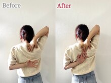 べっぷ餅ヶ浜整体院の雰囲気（肩甲骨剥がしBefore /After◎肩甲骨ケアで背中を柔らかく♪）