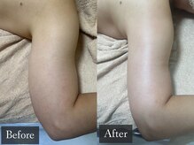 ベルフィーヌ 恵比寿店(BELFINE)/ほっそり二の腕で肌見せ☆