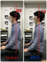 ナオル整体 新宿院(NAORU整体)/30代男性-姿勢矯正 3ヶ月経過