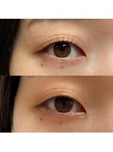 アンリミテッド(Unlimited)/before→after