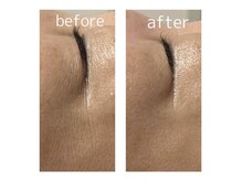 きれい塾 恵比寿/リフティング