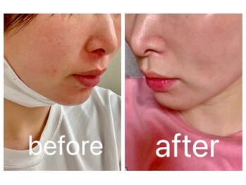 ヨサパーク カズリー(YOSA PARK kazury)/青江の方のオーナーさんの変化!