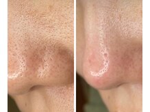 サイ(Sai)/before⇒after