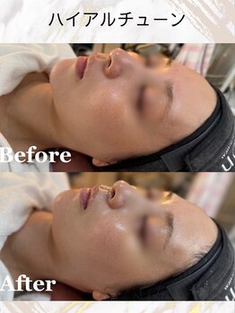 アンベリール(embellir)/韓国人のようなお肌に