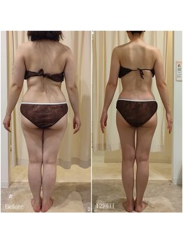 ルノン(Lunon)/《全身痩》全身フォースカッター