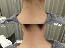 アイロンボーイ(IRONBOY)/うなじ＋首筋WAX ｜脱毛ワックス