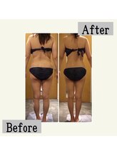 ペールノエル 富士宮店(PERENOEL)/サーモ,インディバetc(30代女性)