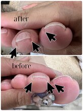 アマリネ(Amarine)/フットケア