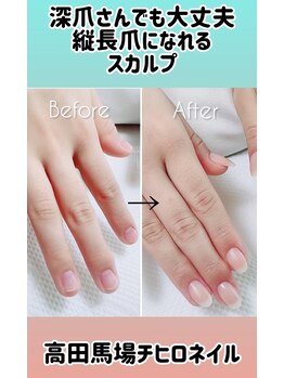 チヒロネイル/縦長ネイルベット自爪風スカルプ