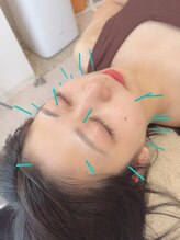 ヒーリングサロン アージュ(A-je)/★美顔鍼＋小顔矯正★