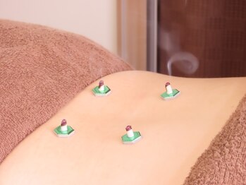 てるてる鍼灸整骨院/お灸