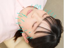 むさし鍼灸整骨院 大宮院の雰囲気（＊美容鍼＊疲れた顔もスッキリ！豊かな表情に♪）