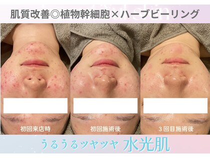ルプレ(Lupure)の写真