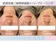 ルプレ(Lupure)の写真