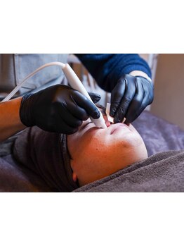 メンズフェイシャル