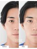 【メンズアイブロウ】眉毛のコンプレックス即解消・HBL+Wax脱毛¥12100