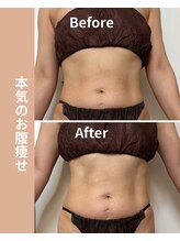 タノソイネ(tanosoine)/【50代/ハイパーナイフ痩身】