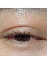 エードット まつげ エステ(a.)/