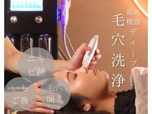 カームアライン(CALM ALIGN)