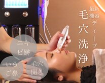 カームアライン(CALM ALIGN)