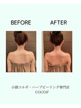 ココ 広島店(COCO)/20代　背中スッキリ！美姿勢