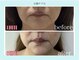 エクラニーク(Eclanique)の写真
