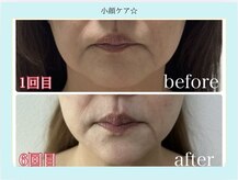 エクラニーク(Eclanique)