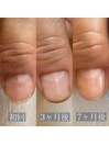 50代　形が悪い