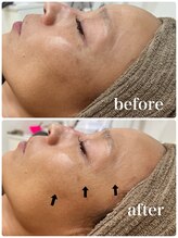 サロン ウイ(salon u'i)/～ゾンビマスク～