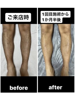 スリール(sourire)/