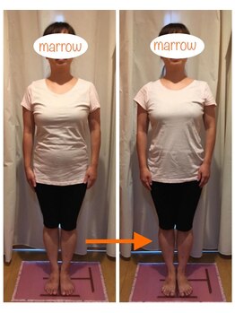 サロンマロウ(salon marrow)/歪み改善でダイエット効果も