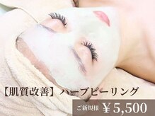 グラシーズ(Glasses)の雰囲気（剥離無し♪毛穴/ニキビ/肌質改善◎韓国漢方ハーブピーリング♪）