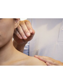 鍼灸施術を受けたい