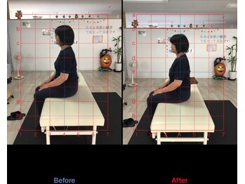 ストレチックス 近江八幡店/姿勢改善ビフォーアフター1回