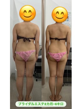 メリアミーゴ(Meli amigo)/