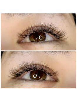 ティーイー(TE)/LEDボリューム80束