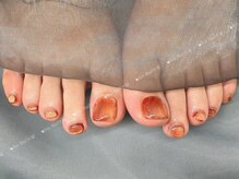 アイリスネイル 大塚(Iris Nail)/フットマグネットネイル