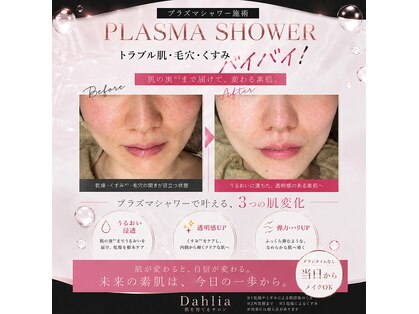 ダリア(Dahlia)の写真
