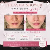 ダリア(Dahlia)