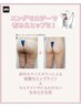 【太もも・ヒップ・脚むくみ】下半身すっきりケア|エンダモロジー最新機種