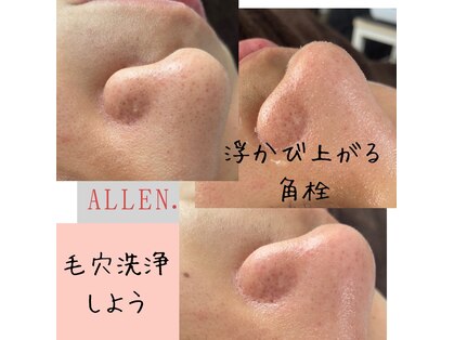 アレン(ALLEN.)の写真