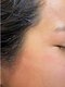 カピリナ(ka pilina)の写真/フェイシャルWAXでハリ艶がプラス☆スッピンはもちろん化粧ノリもUPでメイク後もより肌がキレイに見える♪