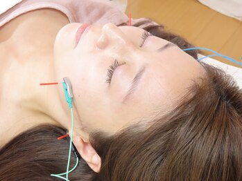 ビシンラボ(美SIN LAB)の写真/【小顔、肩こりもトロける鍼灸♪】リフトアップ美容鍼は、年齢とともに広がり・たるむお顔をスッキリ小顔へ