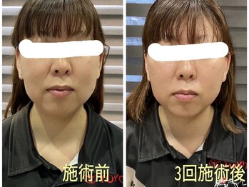 マーガレット整体/微弱電流フェイシャルの施術前後