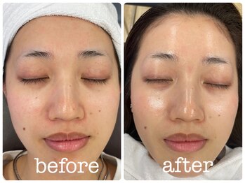 ブリス(BLISS)/シェービング