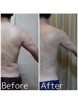 クイーン 熱海店(Queen)/横腹の浮き輪脂肪がなくなったら