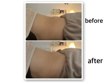 ジョワイユ(Joyeux)/腸の位置でお腹は変わる